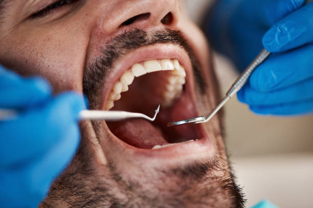 Best Emergency Treatment for Oral Infections in Midway, FL
